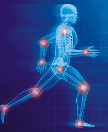 muscle joint pain